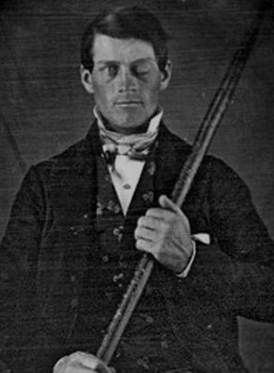 phineas-gage